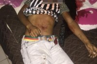 MENOR &Eacute; EXECUTADO COM OITO TIROS NO BAIRRO ZONA SUL EM ARIQUEMES - Foto: Autor / Fonte: alertanoticias.com