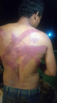 INVASORES TORTURAM, ROUBAM E DERRUBAM CASAS EM FAZENDA NO DISTRITO DE ABUN&Atilde; - Foto: ASSESSORIA