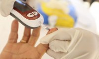 PLANOS DE SA&Uacute;DE INCLUIR&Atilde;O EXAMES PARA DETECTAR O CORONAV&Iacute;RUS - Foto: AG&Ecirc;NCIA BRASIL