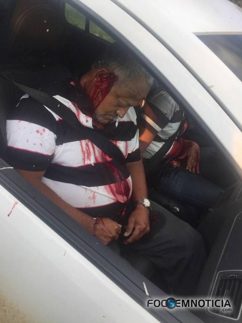 UM &Eacute; EXECUTADO E OUTRO &Eacute; GRAVEMENTE FERIDO NA BR - 421, ATEN&Ccedil;&Atilde;O IMAGENS DE ALTO IMPACTO