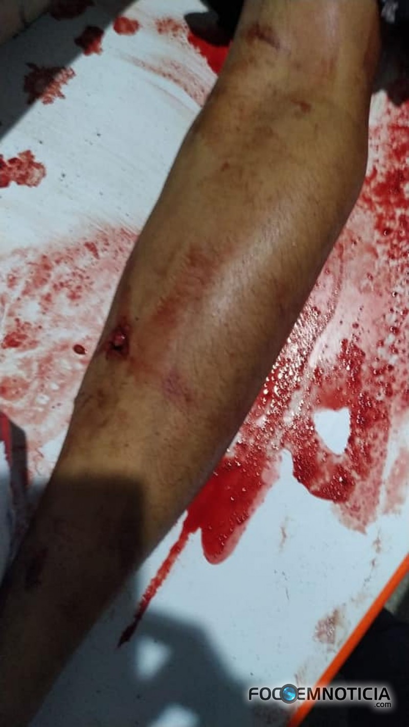 ASSALTANTE QUE FUGIU DO PRES&Iacute;DIO EM ARIQUEMES MORRE AO TROCAR TIROS COM A PM, ATEN&Ccedil;&Atilde;O IMAGENS FORTES