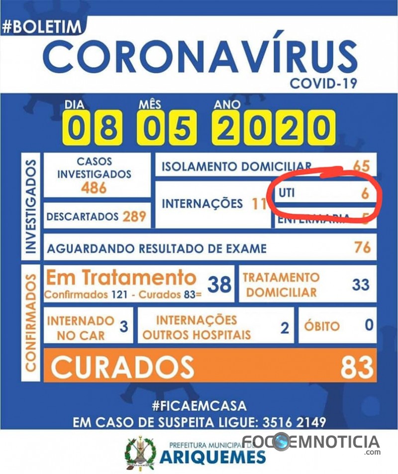 ARIQUEMES CONFIRMA 135 CASOS DE CORONAV&Iacute;RUS E NENHUM &Oacute;BITO