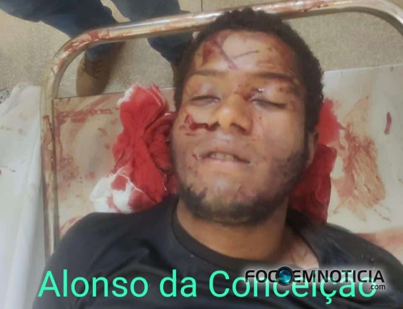 ALONSO DA CONCEI&Ccedil;&Atilde;O FORAGIDO MAIS PERIGOSO DE ARIQUEMES MORRE EM CONFRONTO COM A POL&Iacute;CIA MILITAR