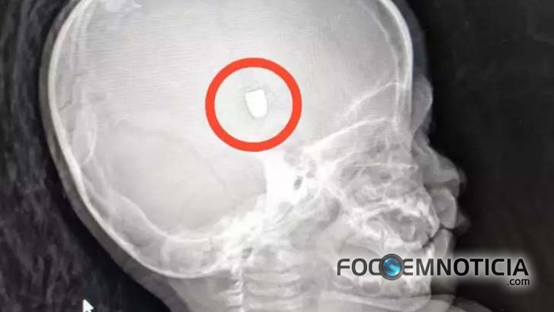 CRIAN&Ccedil;A DE UM ANO E CINCO MESES &Eacute; ATINGIDA NA CABE&Ccedil;A POR TIROS DE PISTOLA NO SETOR 09 EM ARIQUEMES
