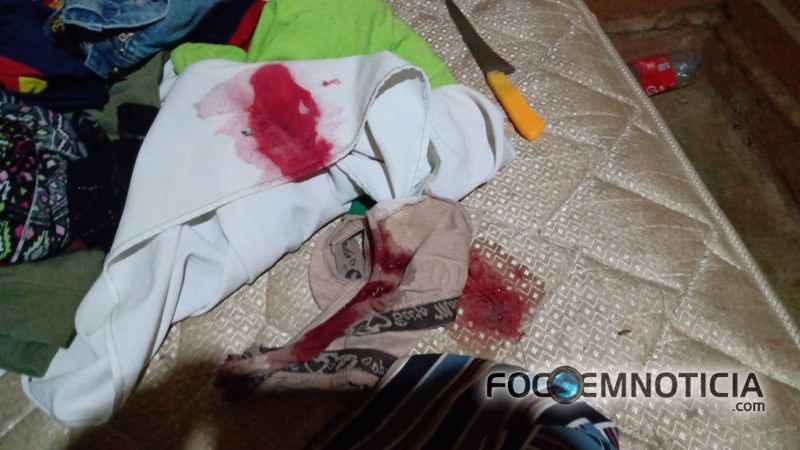 CRIAN&Ccedil;A DE UM ANO E CINCO MESES &Eacute; ATINGIDA NA CABE&Ccedil;A POR TIROS DE PISTOLA NO SETOR 09 EM ARIQUEMES